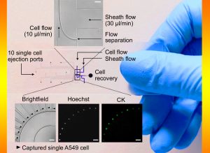 Breakthrough in cancer diagnosis using big data analytics